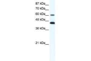 WB Suggested Anti-ANXA6 Antibody Titration:  1.