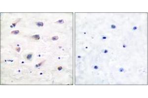 Immunohistochemistry analysis of paraffin-embedded human brain, using PLCB3 (Phospho-Ser1105) Antibody. (PLCB3 Antikörper  (pSer1105))