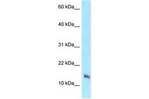 Image no. 1 for anti-NADH Dehydrogenase (Ubiquinone) 1 beta Subcomplex, 7, 18kDa (NDUFB7) (AA 23-72) antibody (ABIN6747893) (NDUFB7 Antikörper  (AA 23-72))