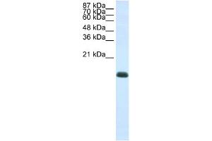 WB Suggested Anti-ZNF786 Antibody Titration:  1. (ZNF786 Antikörper  (N-Term))