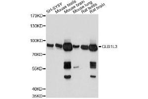 Western blot analysis of extracts of various cell lines, using GLB1L3 antibody. (GLB1L3 Antikörper)