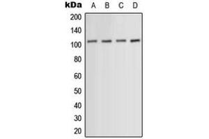 Western blot analysis of ACTN1/2/3/4 expression in HeLa (A), HuvEc (B), mouse muscle (C), PC12 (D) whole cell lysates. (ACTN1/2/3/4 Antikörper  (N-Term))