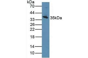 Detection of CD1d in Human K562 Cells using Polyclonal Antibody to Cluster Of Differentiation 1d (CD1d) (CD1d Antikörper  (AA 56-271))