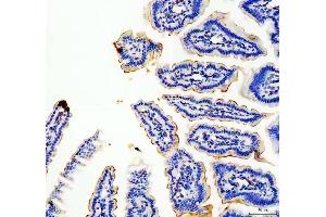 IHC analysis of MUC13 using anti-MUC13 antibody (ABIN6719597).