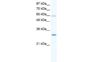WB Suggested Anti-DDX31 Antibody Titration:  2.