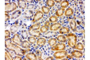 Immunohistochemistry (IHC) image for anti-Cytochrome P450, Family 27, Subfamily B, Polypeptide 1 (CYP27B1) (AA 475-508), (C-Term) antibody (ABIN3042787)