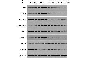 Fasudil protects HUVEC cells from H/R-induced apoptosis(A) MTT was used to determine the IC50 of FSD in HUVEC cells cultured in standard condition. (MLC1 Antikörper  (AA 321-377))