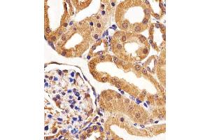 Immunohistochemistry (Paraffin-embedded Sections) (IHC (p)) image for anti-Fms-Related Tyrosine Kinase 4 (FLT4) (AA 1-439) antibody (ABIN1882290)