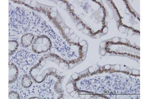 Immunostaining (ISt) image for anti-Transcription Factor 7-Like 2 (T-Cell Specific, HMG-Box) (TCF7L2) (AA 1-455) antibody (ABIN520776)