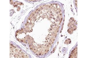 ABIN6267381 at 1/200 staining human testis tissue sections by IHC-P. (BRAF Antikörper  (pThr599))