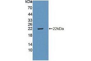 Figure. (CDKN2D Antikörper  (AA 1-166))