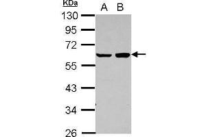 WB Image Sample (30 ug of whole cell lysate) A: A431 B: HeLa 10% SDS PAGE antibody diluted at 1:1000 (PDCD4 Antikörper)