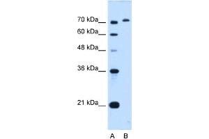 WB Suggested Anti-GPAA1 Antibody Titration:  0. (GPAA1 Antikörper  (C-Term))