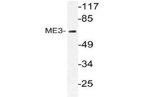 Western blot (WB) analysis of ME3 antibody in extracts from RAW264 cells.