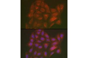 Immunofluorescence analysis of U2OS cells using LML Rabbit pAb (ABIN7268204) at dilution of 1:250 (40x lens). (LMAN2L Antikörper)