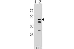 Western Blotting (WB) image for anti-Farnesyl Diphosphate Synthase (FDPS) antibody (ABIN2998304) (FDPS Antikörper)