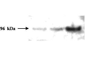 Western blot analysis is shown using  Protein A Purified Mouse Monoclonal Anti-PMS2 antibody to detect human PMS2 protein present in H157 cell lysates. (PMS2 Antikörper)