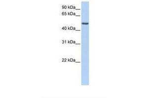 Image no. 1 for anti-Pleckstrin Homology-Like Domain, Family A, Member 1 (PHLDA1) (AA 290-339) antibody (ABIN6739003) (PHLDA1 Antikörper  (AA 290-339))