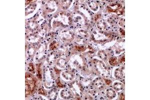 Immunohistochemical analysis of Perforin 1 staining in human kidney formalin fixed paraffin embedded tissue section. (Perforin 1 Antikörper  (C-Term))