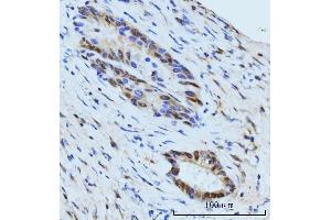 IHC analysis of SBNO1 using anti-SBNO1 antibody (ABIN7601710). (SBNO1 Antikörper  (AA 43-1303))