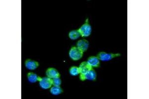 ICC/IF analysis of IRF5 in THP-1 cells line, stained with DAPI (Blue) for nucleus staining and monoclonal anti-human THP-1 antibody (1:100) with goat anti-mouse IgG-Alexa fluor 488 conjugate (Green). (IRF5 Antikörper)