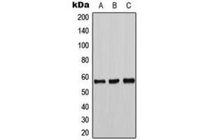 Western blot analysis of Tyrosine Hydroxylase expression in DLD (A), mouse liver (B), PC12 (C) whole cell lysates. (Tyrosine Hydroxylase Antikörper  (N-Term))