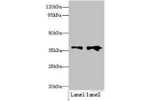Western blot All lanes: RPRD1B antibody at 0. (RPRD1B Antikörper  (AA 2-172))
