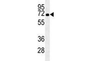 HSPA1A antibody western blot analysis in HL-60 lysate. (HSP70 1A Antikörper  (AA 574-600))