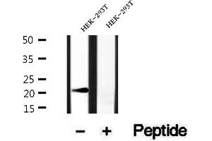 Western blot analysis of extracts of HEK-293T cells, using BBS3 antibody. (ARL6 Antikörper  (Internal Region))
