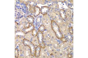 Immunohistochemistry of paraffin-embedded rat kidney using MMP14 antibody. (MMP14 Antikörper)
