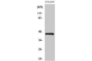 Western Blotting (WB) image for anti-Tumor Suppressor Candidate 3 (TUSC3) (Internal Region) antibody (ABIN3176197) (TUSC3 Antikörper  (Internal Region))