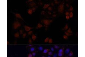 Immunofluorescence analysis of HeLa cells using MAPRE1 Polyclonal Antibody at dilution of 1:100. (MAPRE1 Antikörper)