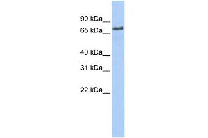 WB Suggested Anti-MARCH7 Antibody Titration:  0. (MARCH7 Antikörper  (Middle Region))