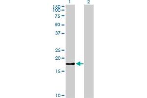 Western Blot analysis of BIRC5 expression in transfected 293T cell line by BIRC5 monoclonal antibody (M01), clone 5B10.