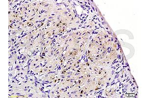 Formalin-fixed and paraffin embedded rat uterine myoma labeled with Rabbit Anti-ER-beta Polyclonal Antibody (ABIN725735) at 1:200 followed by conjugation to the secondary antibody and DAB staining. (TACR3 Antikörper  (AA 151-250))