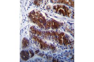 FRK Antibody (N-term) (ABIN392097 and ABIN2841849) immunohistochemistry analysis in formalin fixed and paraffin embedded human stomach tissue followed by peroxidase conjugation of the secondary antibody and DAB staining. (FRK Antikörper  (N-Term))