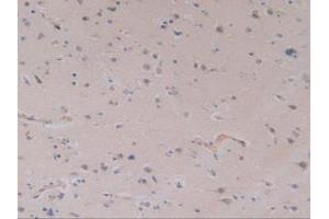 IHC-P analysis of Human Brain Tissue, with DAB staining. (TLR9 Antikörper  (AA 28-362))
