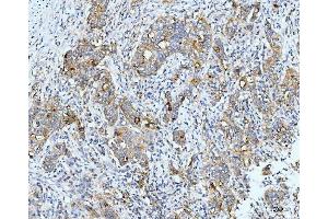 IHC analysis of Neurofibromin/NF1 using anti-Neurofibromin/NF1 antibody (ABIN7600197). (Neurofibromin 1 Antikörper  (AA 160-270))