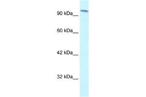 Western Blotting (WB) image for anti-SWI/SNF Related, Matrix Associated, Actin Dependent Regulator of Chromatin, Subfamily C, Member 1 (SMARCC1) (C-Term) antibody (ABIN2777854)