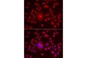 Immunofluorescence analysis of A549 cells using GORASP1 antibody (ABIN5973972).