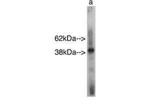 Image no. 1 for anti-Sterile alpha Motif Domain Containing 8 (SAMD8) antibody (ABIN793629) (SAMD8 Antikörper)