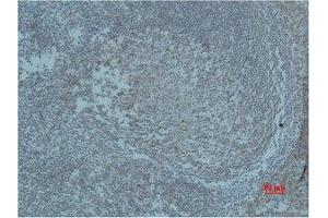 Immunohistochemistry (IHC) analysis of paraffin-embedded Human Tonsil Tissue using HIF-1beta Polyclonal Antibody. (ARNT Antikörper)