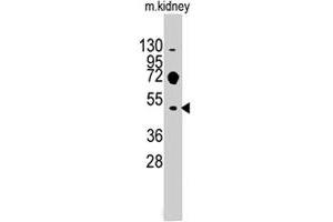 Western blot analysis of Evx2 polyclonal antibody  in mouse kidney tissue lysates (35 ug/lane). (EVX2 Antikörper  (C-Term))