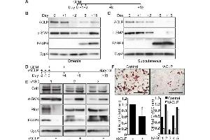 Western Blotting (WB) image for anti-Collagen, Type I (COL1) antibody (ABIN5596819)