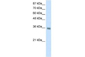 WB Suggested Anti-HNRPA1 Antibody Titration:  1. (HNRNPA1 Antikörper  (C-Term))