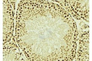 ABIN6276700 at 1/100 staining Mouse testis tissue by IHC-P. (HDAC9 Antikörper  (C-Term))