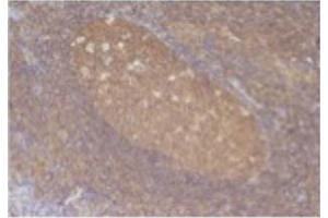 Image no. 1 for anti-Chemokine (C-C Motif) Ligand 5 (CCL5) antibody (ABIN465158) (CCL5 Antikörper)