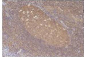 Image no. 1 for anti-Chemokine (C-C Motif) Ligand 5 (CCL5) antibody (ABIN465158)