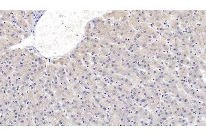 Detection of SEMA3A in Human Liver Tissue using Monoclonal Antibody to Semaphorin 3A (SEMA3A) (SEMA3A Antikörper  (AA 580-664))