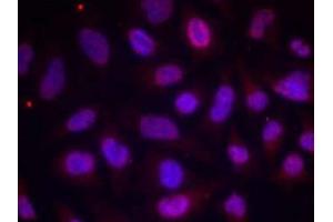 Immunofluorescence staining of methanol-fixed HeLa cells using MEF2A (phospho-Thr312) antibody (E011039, Red) (MEF2A Antikörper  (pThr312))